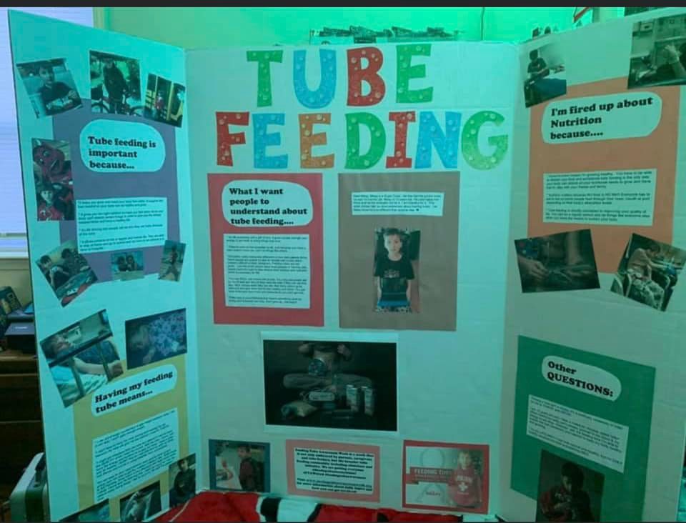 trifold posterboard about tubefeeding